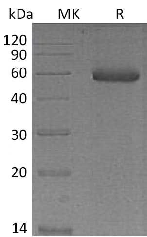 Recombinant Mouse NGAL/Lipocalin-2 Protein (Fc Tag) - ABMIUM