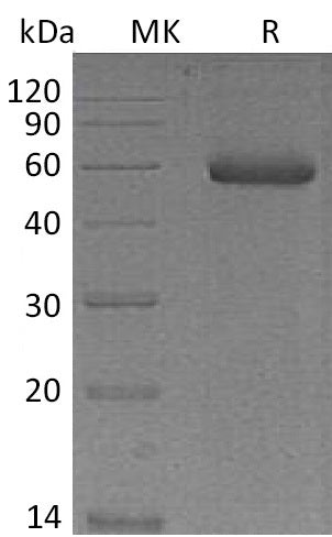 Recombinant Mouse NGAL/Lipocalin-2 Protein (Fc Tag) - ABMIUM