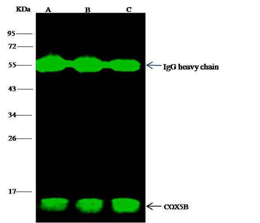 Anti-Human COX5B Antibody [A1208] - ABMIUM