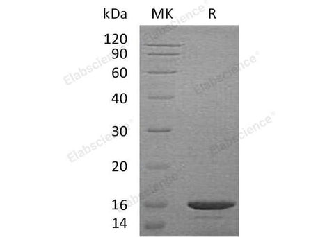 Recombinant Mouse CCL21a Protein - ABMIUM
