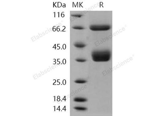 > 98 % as determined by reducing SDS-PAGE.
