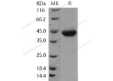 Recombinant Human Galanin/GAL Protein (Fc Tag) - ABMIUM