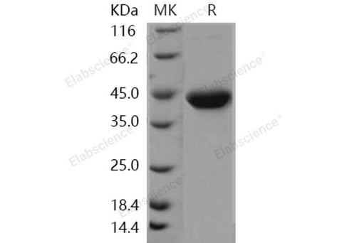 Recombinant Human Galanin/GAL Protein (Fc Tag) - ABMIUM