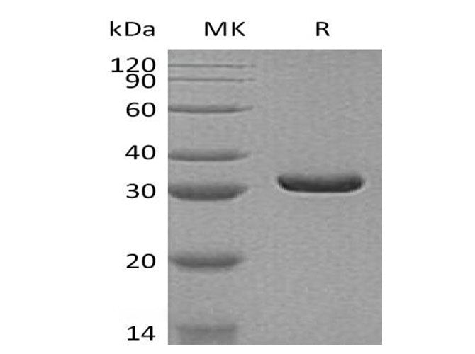 Recombinant Human MDH2 Protein (His Tag) - ABMIUM