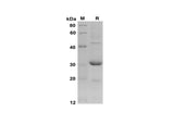 SDS-PAGE analysis of Mouse CCL2/JE/MCP-1 proteins, 2 μg/lane of Recombinant Mouse CCL2/JE/MCP-1 proteins was resolved with SDS-PAGE under reducing conditions, showing bands at 30 kDa.
