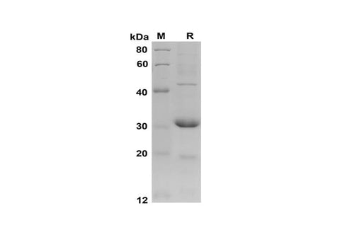 SDS-PAGE analysis of Mouse CCL2/JE/MCP-1 proteins, 2 μg/lane of Recombinant Mouse CCL2/JE/MCP-1 proteins was resolved with SDS-PAGE under reducing conditions, showing bands at 30 kDa.
