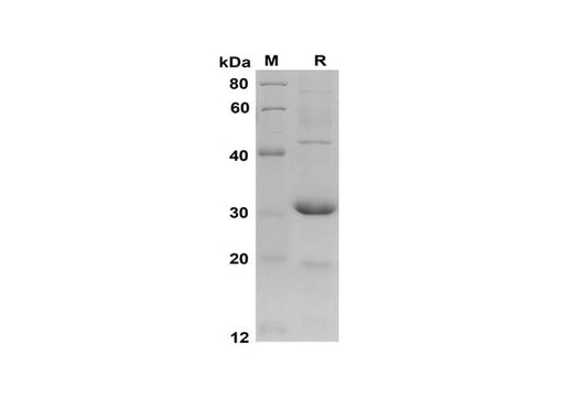 SDS-PAGE analysis of Mouse CCL2/JE/MCP-1 proteins, 2 μg/lane of Recombinant Mouse CCL2/JE/MCP-1 proteins was resolved with SDS-PAGE under reducing conditions, showing bands at 30 kDa.