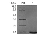 Recombinant Human Pro-Neuropeptide Y/NPY Protein (His Tag) - ABMIUM