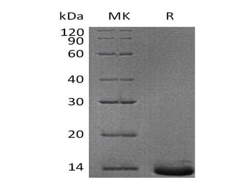 Recombinant Human Pro-Neuropeptide Y/NPY Protein (His Tag) - ABMIUM