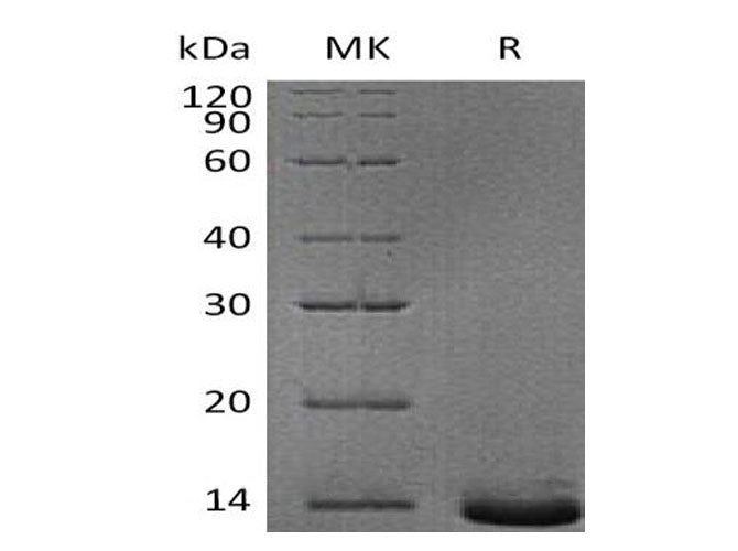 Recombinant Human Pro-Neuropeptide Y/NPY Protein (His Tag) - ABMIUM