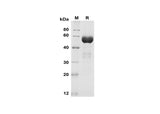 SDS-PAGE analysis of Mouse EpCAM/TROP-1 proteins, 2 μg/lane of Recombinant Mouse EpCAM/TROP-1 proteins was resolved with SDS-PAGE under reducing conditions, showing bands at 55 kDa.