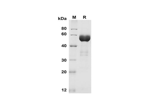 SDS-PAGE analysis of Mouse EpCAM/TROP-1 proteins, 2 μg/lane of Recombinant Mouse EpCAM/TROP-1 proteins was resolved with SDS-PAGE under reducing conditions, showing bands at 55 kDa.