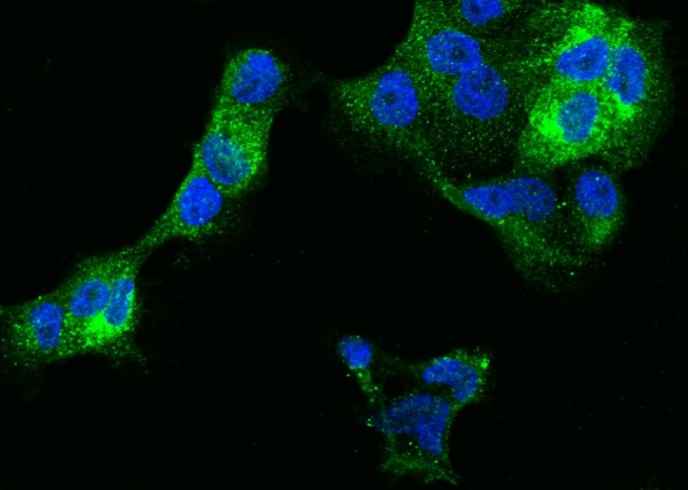 Anti-Human IFITM1 Antibody [A1284] - ABMIUM