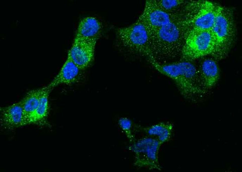 Anti-Human IFITM1 Antibody [A1284] - ABMIUM