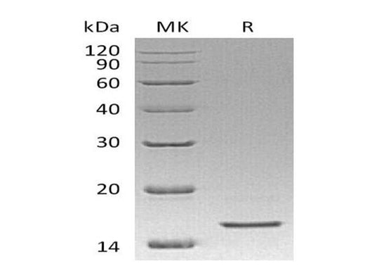 Recombinant Human REG4/RELP Protein (His Tag) - ABMIUM