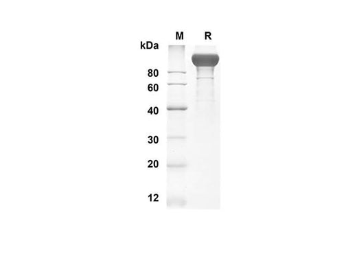 SDS-PAGE analysis of Mouse VEGFR2 proteins, 2 μg/lane of Recombinant Mouse VEGFR2 proteins was resolved with an SDS-PAGE under reducing conditions, showing bands at 81.6 kDa.