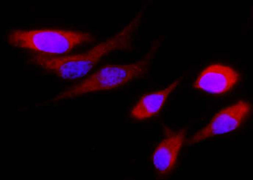 Anti-Human CST4 Antibody [B328] - ABMIUM