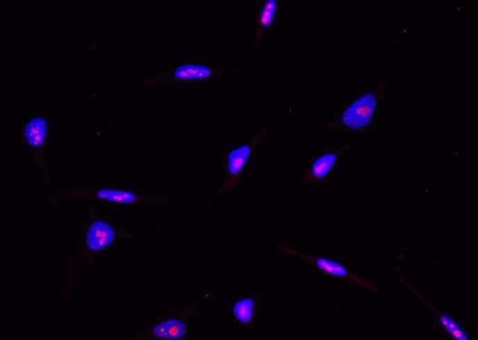 Anti-Human ABHD14B Antibody [B372] - ABMIUM