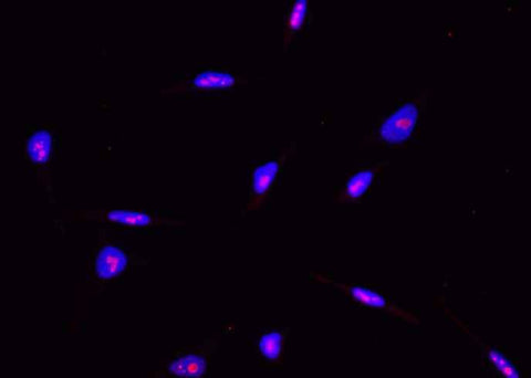 Anti-Human ABHD14B Antibody [B372] - ABMIUM