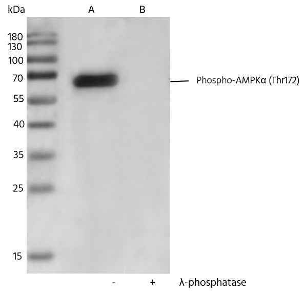 Anti-Human PRKAA1 Antibody [B291] - ABMIUM