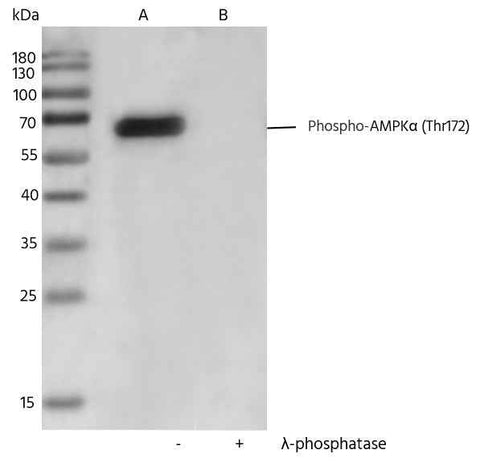 Anti-Human PRKAA1 Antibody [B291] - ABMIUM