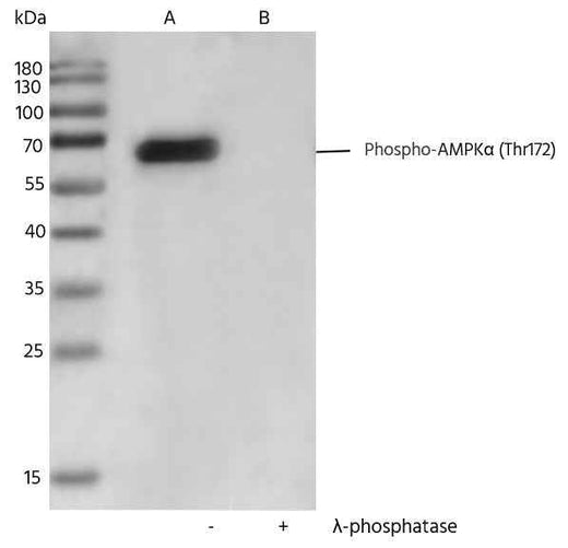 Anti-Human PRKAA1 Antibody [B291] - ABMIUM