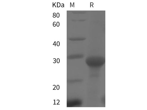 SDS-PAGE analysis of Rat TGFBR1 proteins, 2 μg/lane of Recombinant Rat TGFBR1 proteins was resolved with SDS-PAGE under reducing conditions, showing bands at 28 kDa.