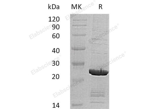 Recombinant Human SOD2/Mn-SOD Protein (His Tag, Human Cells) - ABMIUM
