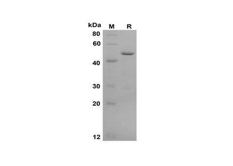 SDS-PAGE analysis of Human Galectin-3 proteins, 2 μg/lane of Recombinant Human Galectin-3 proteins was resolved with SDS-PAGE under reducing conditions, showing bands at 53 kDa.