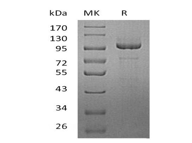 Recombinant Human Protocadherin-10/PCDH10 Protein (His Tag) - ABMIUM