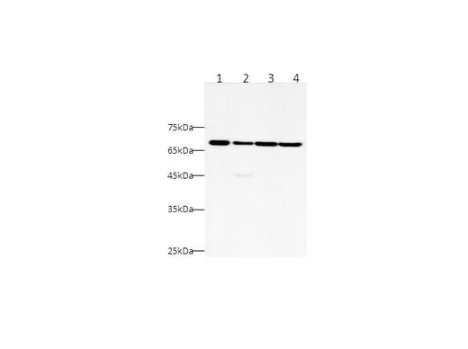 Anti-Human CK5P3 Antibody - ABMIUM