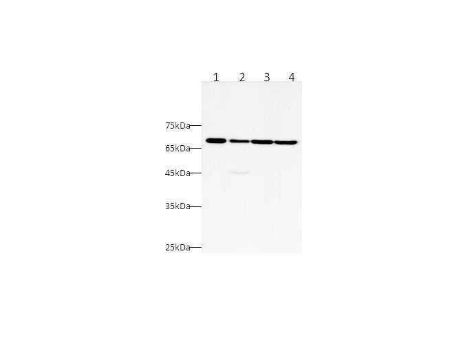 Anti-Human CK5P3 Antibody - ABMIUM