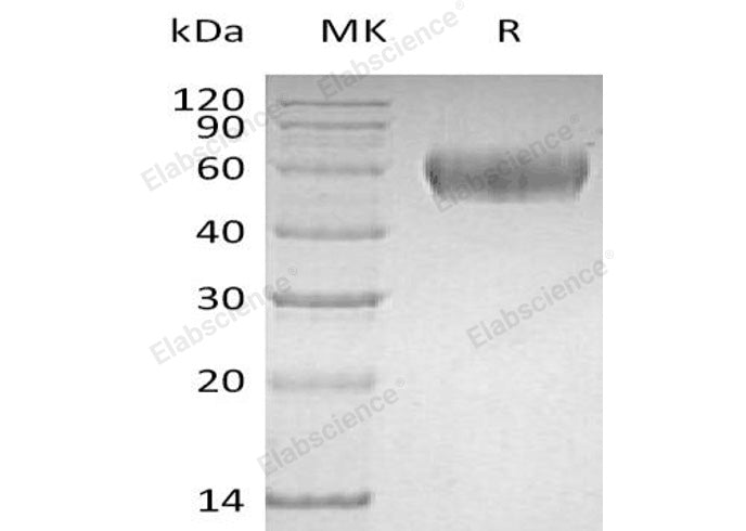 Recombinant Human Lumican/LUM Protein (His Tag) - ABMIUM