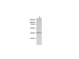 Anti-Mouse PAI1 Antibody - ABMIUM