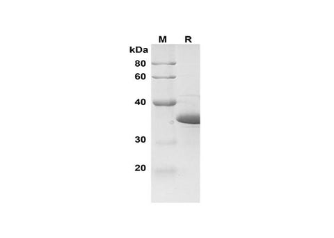 SDS-PAGE analysis of Human SIRT3 proteins, 2 μg/lane of Recombinant Human SIRT3 proteins was resolved with SDS-PAGE under reducing conditions, showing bands at 36 kDa.