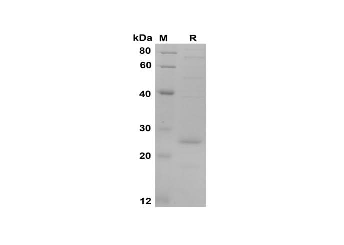 SDS-PAGE analysis of Human FNDC5 proteins, 2 μg/lane of Recombinant Human FNDC5 proteins was resolved with SDS-PAGE under reducing conditions, showing bands at 25 kDa.