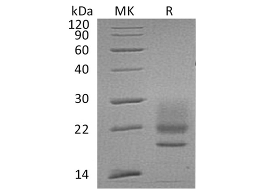 Recombinant Human CD83/HB15 Protein (His Tag) - ABMIUM