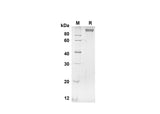 SDS-PAGE analysis of Human ANPEP proteins, 2 μg/lane of Recombinant Human ANPEP proteins was resolved with SDS-PAGE under reducing conditions, showing bands at 98.8 kDa.