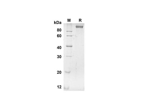 SDS-PAGE analysis of Human ANPEP proteins, 2 μg/lane of Recombinant Human ANPEP proteins was resolved with SDS-PAGE under reducing conditions, showing bands at 98.8 kDa.