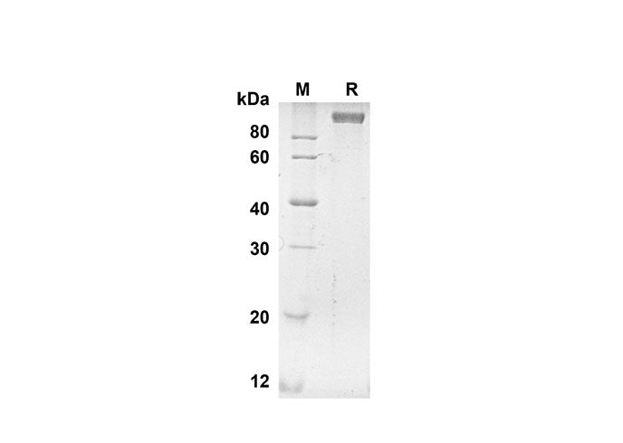 SDS-PAGE analysis of Human ANPEP proteins, 2 μg/lane of Recombinant Human ANPEP proteins was resolved with SDS-PAGE under reducing conditions, showing bands at 98.8 kDa.