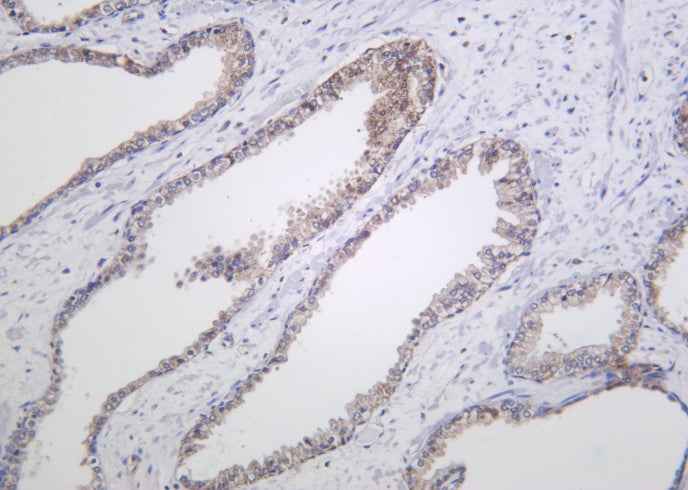 Anti-Human/Mouse/Rat Raf-B Antibody [B1020] - ABMIUM