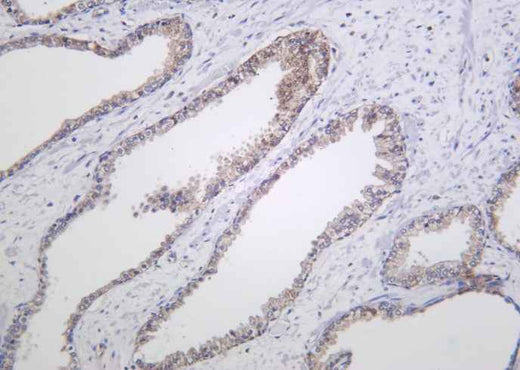 Anti-Human/Mouse/Rat Raf-B Antibody [B1020] - ABMIUM