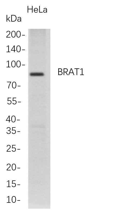 Anti-Human BRAT1 Antibody [B718] - ABMIUM