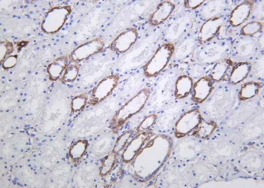 Anti-Human/Mouse/Rat HXK I Antibody [B1019] - ABMIUM