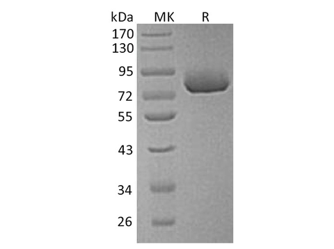 Recombinant Human XPNPEP2 Protein (His Tag) - ABMIUM