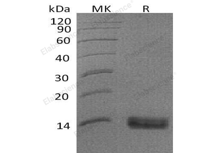 Recombinant Human SPINK1 Protein (His Tag) - ABMIUM