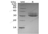 Recombinant Human CTRL Protein (His Tag) - ABMIUM