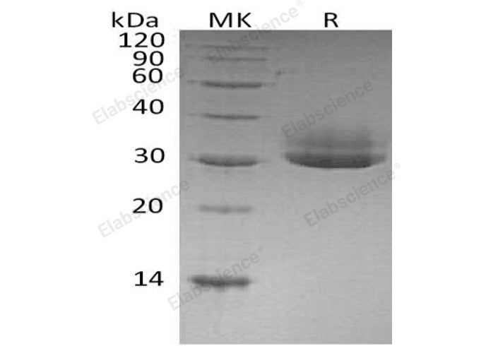 Recombinant Human CTRL Protein (His Tag) - ABMIUM