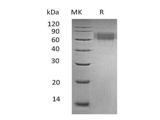 Recombinant Human Ameloblastin/AMBN Protein (His Tag) - ABMIUM