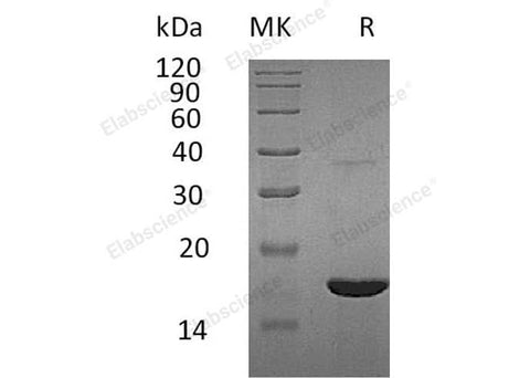 Recombinant Human REG3G/PAP-1B Protein (His Tag) - ABMIUM